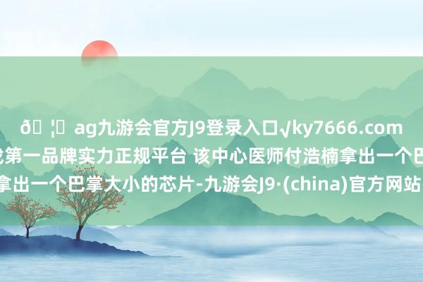 🦄ag九游会官方J9登录入口√ky7666.com√ag九游会官网真人游戏第一品牌实力正规平台 　　该中心医师付浩楠拿出一个巴掌大小的芯片-九游会J9·(china)官方网站-真人游戏第一品牌